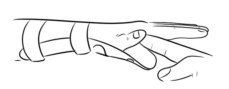Thumb tendon extensor exercise 1.jpg