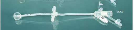 balloon gastrostomy.png