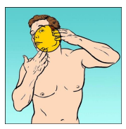 Melanoma_1.png
