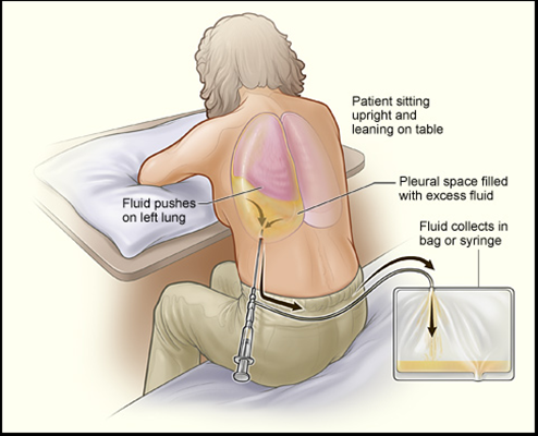 pleural clinic.png