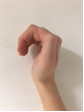 mallet injury 2.png