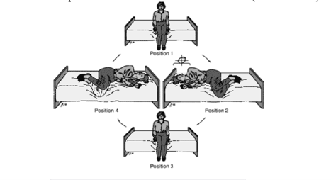 Brandt-Daroff Exercises.png