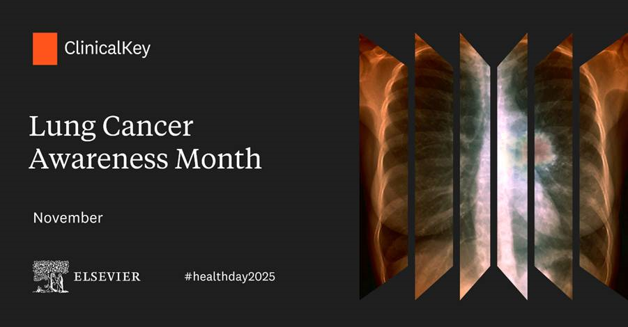 Clinical key lung cancer awareness flyer