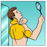 Melanoma_6.png