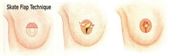 nipple 1.jpg