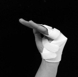 metacarpal fracture exercise.jpg
