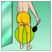 Melanoma_7.png