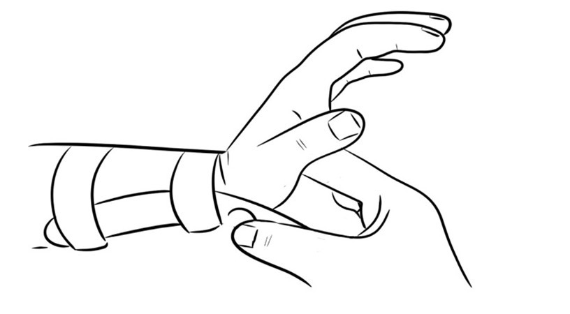 Thumb tendon extensor exercise 3.jpg