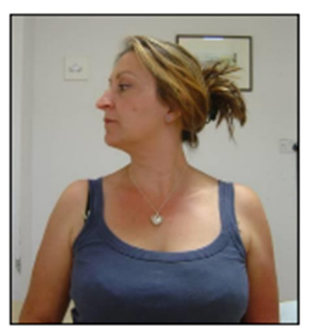 neck rotation (R&L).png