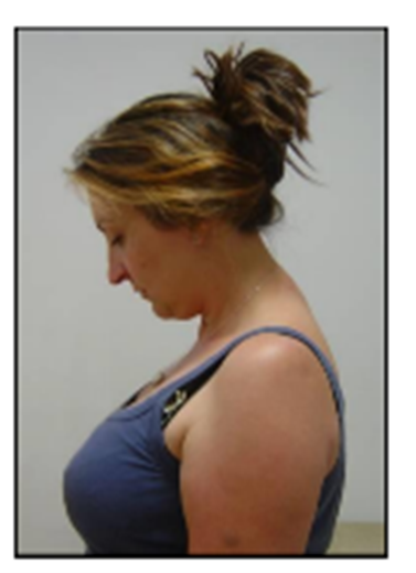 neck flexion.png