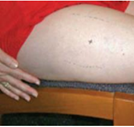 Locate injection site