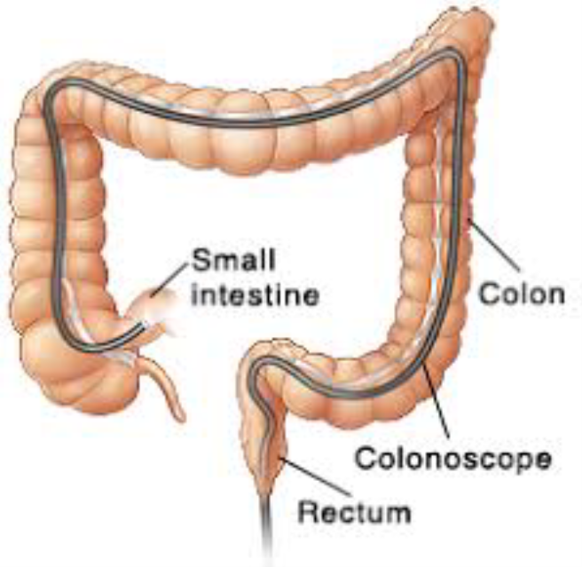 Colon.png