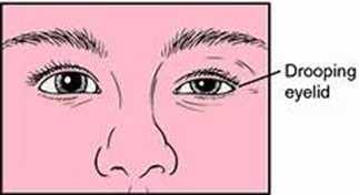 Eye.jpg