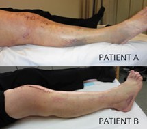 swelling and bruising `.jpg