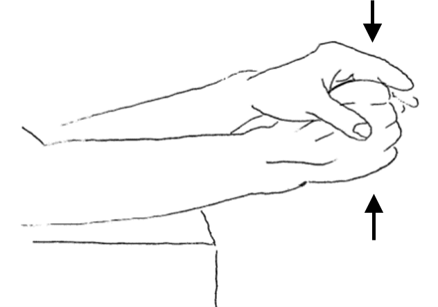 radial deviation.png