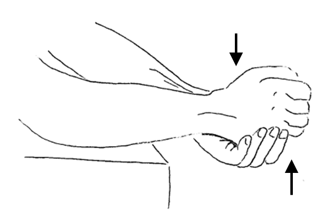 Ulnar deviation.png