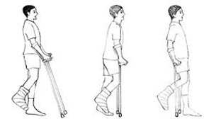 How to Walk with Elbow Crutches.jpg