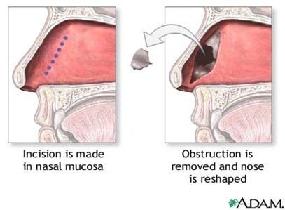 nose diagram.jpg