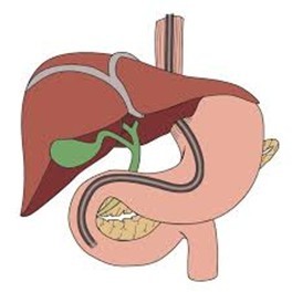endoscopy 1.jpg