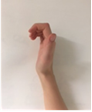 Mallet injury 1.png