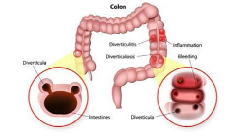 colon.png