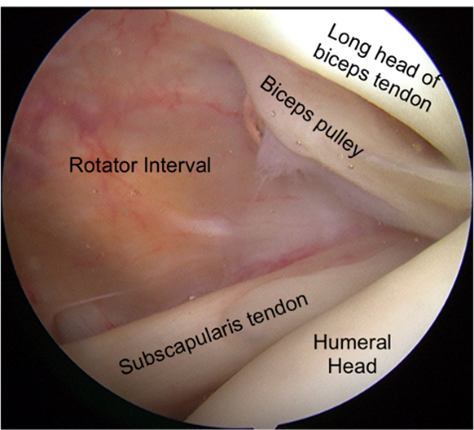 normal shoulder.png
