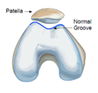 normal groove.png