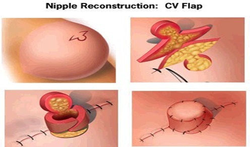 nipple 2.jpg