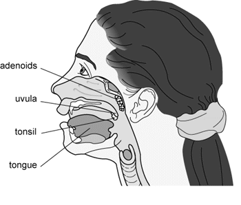 Adenoidectomy.png