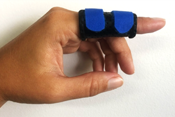 Central slip injury 1.png