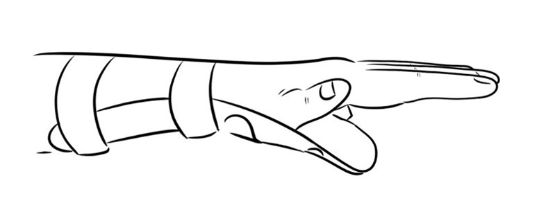 Thumb tendon extensor exercise 2.jpg