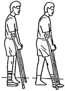 Partial Weight Bearing.png