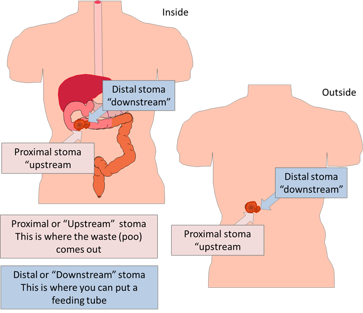 Distal limb feeding.png