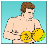 Melanoma_3.png