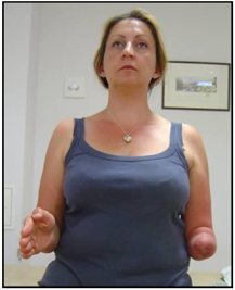 shoulder extermal rotation.png