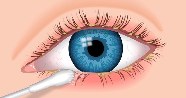 lash cleaning on the lash roots.jpg