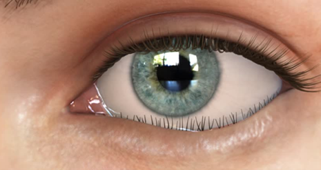 Illustration of an eyelid turning inwards.jpg.png