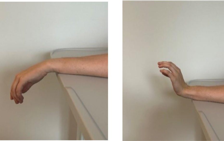 Wrist flexion and extension.png