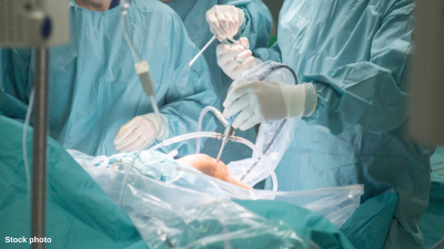 Library image of a patient undergoing knee surgery